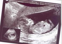 baby burkel 12.4wk 2.jpg