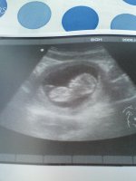 13 week scan resize.jpg