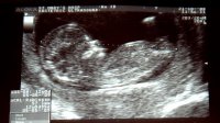 Baby.jpg