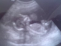 scan2 17wks4days.jpg