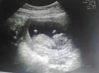 Baby - 12 weeks.jpg