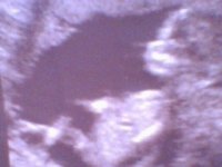 n514193283_317679_3498.jpg