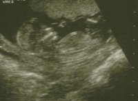 12 wks +3 flipped.jpg