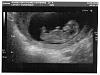 smallscan.JPG
