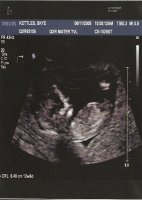 baby 12w6d.jpg