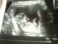 Baby Robertson 13 weeks 2.jpg
