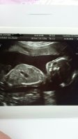 my boy 20weeks.jpg