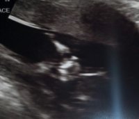 12w4d3b.jpg