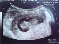 babybean10weeks.jpg