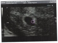 TheSack@4weeks.jpg