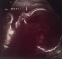 32 week pic.jpg