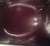 32 week hair pic.jpg