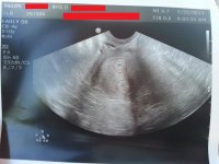 ultrasound.jpg