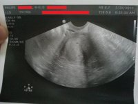 ultrasound2.jpg
