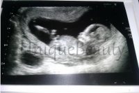 13 weeks scan.jpg