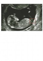 baby scan 2 alt.jpg