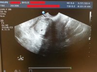 ultrasound3.jpg