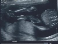 Baby Sono 1.jpg