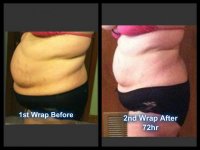 1st and 2nd wrap side before and afters.jpg
