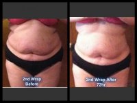 2nd wrap front before and after 72hr.jpg