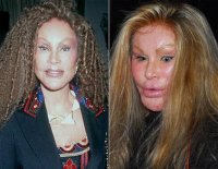 record_plastic_surgery_011.jpg