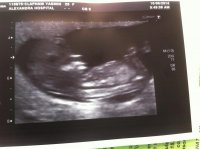 Baby Baylis 12wks 4 days 2.jpg