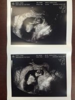 baby M.jpg