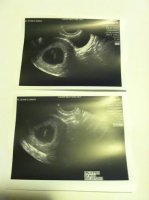 ultrasoun 6+5.jpg