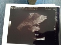 ultrasound1.jpg