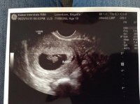 ultrasound2.jpg