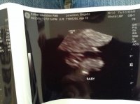 ultrasound3.jpg