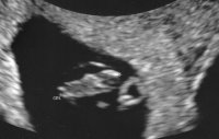 babyb0625.jpg