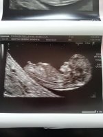 11w 5d.jpg