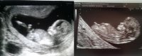 Jayden and baby#2.jpg