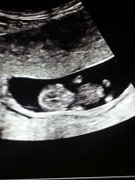 10w6d3.jpeg