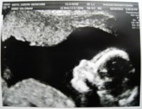 Alia 20 week scan.jpg