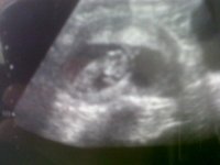 Baby%20A.jpg