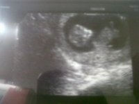 Baby%20B.jpg