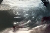 20weeks2.jpg