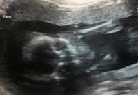 20weeks1.jpg