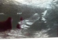 20weeks3.jpg