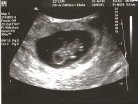 ultrasound - 8 weeks.jpg