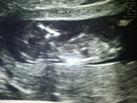 Baby%20B.jpg