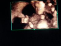 14w6d2.jpeg