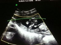 14w6d3.jpeg
