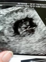 ultrasound1.jpg