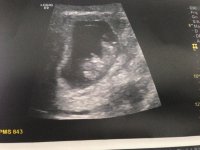 9wks 5days.jpg