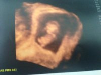 9wks 5 days_3D.jpg
