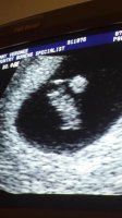 7weeks 4 day ultrasound.jpg