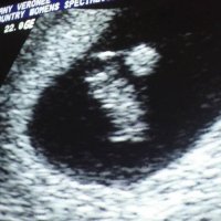 7w4d ultrasound.jpg